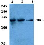 PHKB Antibody in Western Blot (WB)