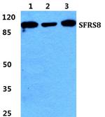 SFRS8 Antibody in Western Blot (WB)