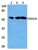 TADA2L Antibody in Western Blot (WB)