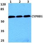 CYP8B1 Antibody in Western Blot (WB)