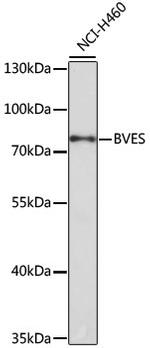 BVES Antibody in Western Blot (WB)