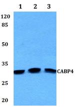 CABP4 Antibody in Western Blot (WB)