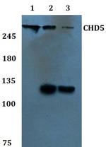 CHD5 Antibody in Western Blot (WB)