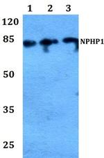 NPHP1 Antibody in Western Blot (WB)