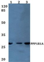 PPP1R1A Antibody in Western Blot (WB)