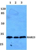 RAB23 Antibody in Western Blot (WB)