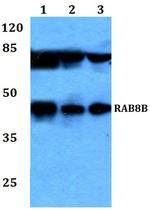 RAB8B Antibody in Western Blot (WB)