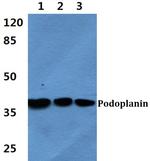 Podoplanin Antibody in Western Blot (WB)