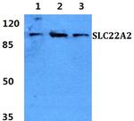 SLC22A2 Antibody in Western Blot (WB)