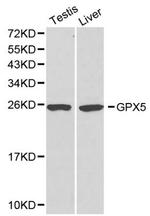 GPX5 Antibody in Western Blot (WB)