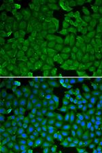 SPINK1 Antibody in Immunocytochemistry (ICC/IF)