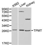 TPMT Antibody in Western Blot (WB)