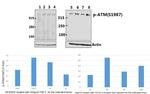 Phospho-ATM (Ser1987) Antibody in Western Blot (WB)