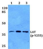 Phospho-LAT (Tyr255) Antibody in Western Blot (WB)