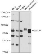 CSF2RA Antibody in Western Blot (WB)