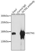 Dynactin 1 Antibody in Immunoprecipitation (IP)