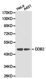 DDB2 Antibody in Western Blot (WB)
