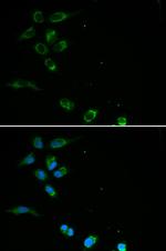 HFE Antibody in Immunocytochemistry (ICC/IF)