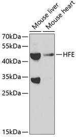 HFE Antibody in Western Blot (WB)