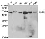 HMBS Antibody in Western Blot (WB)