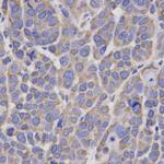 HMGCR Antibody in Immunohistochemistry (Paraffin) (IHC (P))