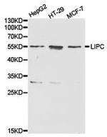 LIPC Antibody in Western Blot (WB)