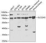 SLC22A5 Antibody in Western Blot (WB)