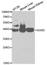 Sorbitol Dehydrogenase Antibody in Western Blot (WB)