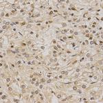 LETMD1 Antibody in Immunohistochemistry (Paraffin) (IHC (P))