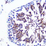 LETMD1 Antibody in Immunohistochemistry (Paraffin) (IHC (P))