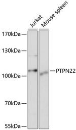 PTPN22 Antibody in Western Blot (WB)