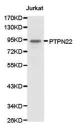 PTPN22 Antibody in Western Blot (WB)