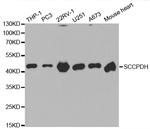 SCCPDH Antibody in Western Blot (WB)