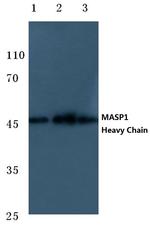 MASP1 Antibody in Western Blot (WB)