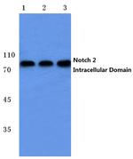 NOTCH2 (Cleaved Ala1734) Antibody in Western Blot (WB)