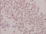 Laminin gamma-3 Antibody in Immunohistochemistry (Paraffin) (IHC (P))