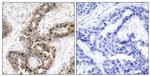 Phospho-p21 (Thr145) Antibody in Immunohistochemistry (Paraffin) (IHC (P))