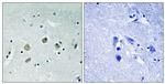 Phospho-TPL2 (Ser400) Antibody in Immunohistochemistry (Paraffin) (IHC (P))