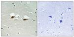 Phospho-ATF2 (Ser472) Antibody in Immunohistochemistry (Paraffin) (IHC (P))