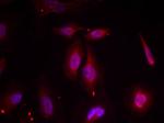 Phospho-ATF2 (Thr51, Thr69) Antibody in Immunocytochemistry (ICC/IF)