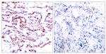 Phospho-ATF2 (Thr53, Thr71) Antibody in Immunohistochemistry (Paraffin) (IHC (P))