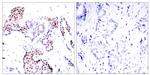 Phospho-ELK1 (Ser389) Antibody in Immunohistochemistry (Paraffin) (IHC (P))