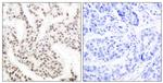 Phospho-ELK1 (Thr417) Antibody in Immunohistochemistry (Paraffin) (IHC (P))