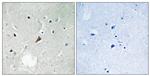 Phospho-PYK2 (Tyr579) Antibody in Immunohistochemistry (Paraffin) (IHC (P))