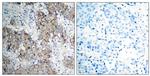 Phospho-IGF1R beta (Tyr1161) Antibody in Immunohistochemistry (Paraffin) (IHC (P))