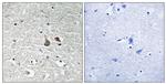 Phospho-IRAK1 (Ser376) Antibody in Immunohistochemistry (Paraffin) (IHC (P))