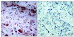 Phospho-JAK1 (Tyr1022) Antibody in Immunohistochemistry (Paraffin) (IHC (P))