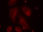 Phospho-LIMK1 (Thr508) Antibody in Immunocytochemistry (ICC/IF)