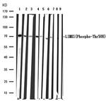 Phospho-LIMK1 (Thr508) Antibody in Immunohistochemistry (Paraffin) (IHC (P))