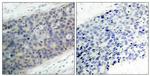 Phospho-LIMK2 (Thr505) Antibody in Immunohistochemistry (Paraffin) (IHC (P))